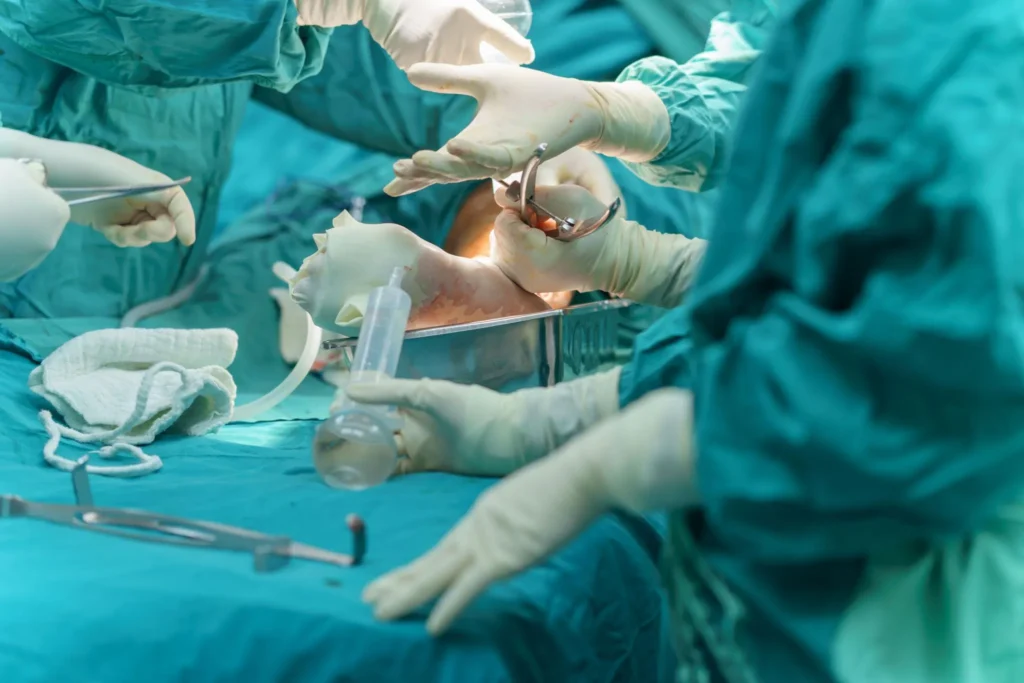 Successful Multi-Fracture Reconstruction After Severe Road Trauma